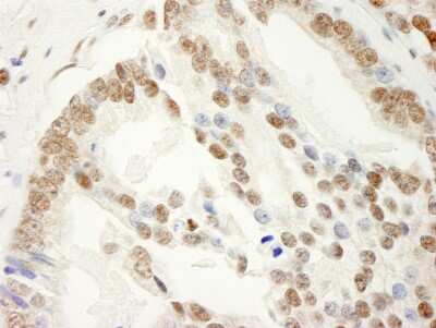 Immunohistochemistry-Paraffin: SAM68 Antibody [NBP1-19151]