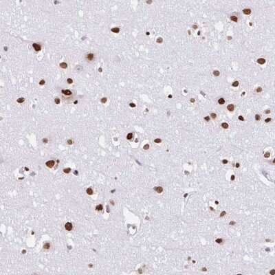 Immunohistochemistry: SAM68 Antibody [NBP2-38645]