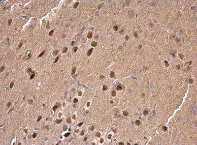 Immunohistochemistry-Paraffin: SAM68 Antibody [NBP2-20254]