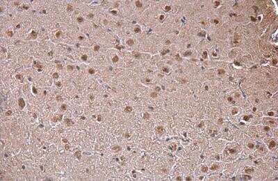 Immunohistochemistry-Paraffin: SAM68 Antibody [NBP2-20254]