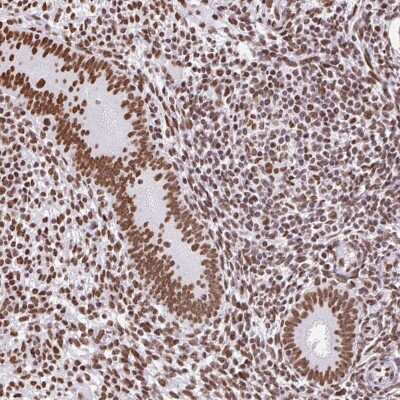 Immunohistochemistry-Paraffin: SAM68 Antibody [NBP2-38645]