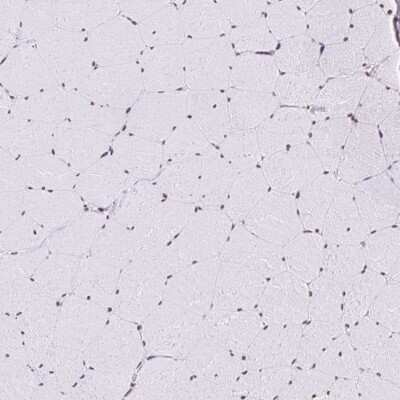 Immunohistochemistry-Paraffin: SAM68 Antibody [NBP2-38645]
