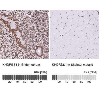 Immunohistochemistry-Paraffin: SAM68 Antibody [NBP2-38645]