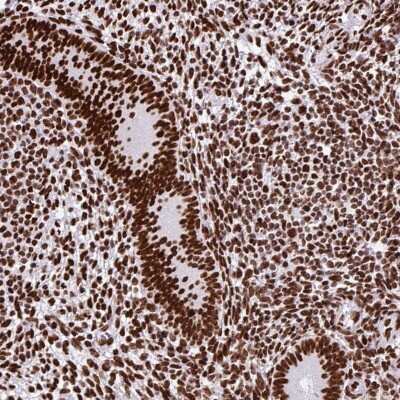 Immunohistochemistry-Paraffin: SAM68 Antibody [NBP2-38805]