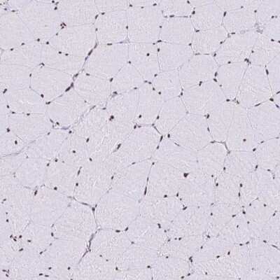 Immunohistochemistry-Paraffin: SAM68 Antibody [NBP2-38805]