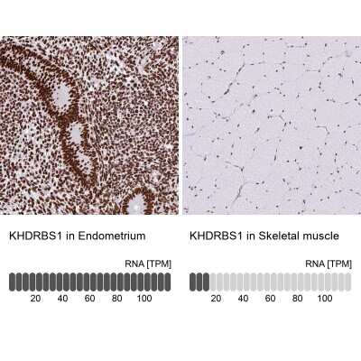 Immunohistochemistry-Paraffin: SAM68 Antibody [NBP2-38805]