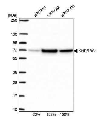 Western Blot: SAM68 Antibody [NBP2-38645]