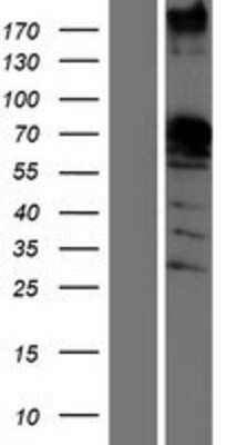 Western Blot: SAM68 Overexpression Lysate [NBP2-10404]