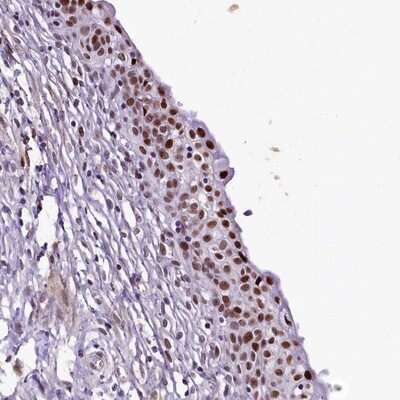 Immunohistochemistry-Paraffin: SAMD10 Antibody [NBP1-88305]