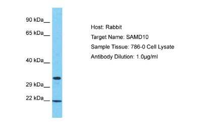 Western Blot: SAMD10 Antibody [NBP2-83491]