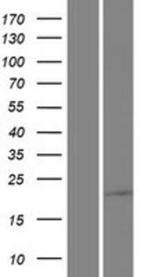 Western Blot: SAMD10 Overexpression Lysate [NBP2-05780]