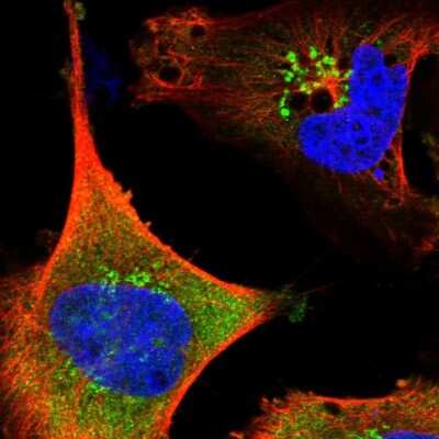 Immunocytochemistry/ Immunofluorescence: SAMD12 Antibody [NBP1-81927]