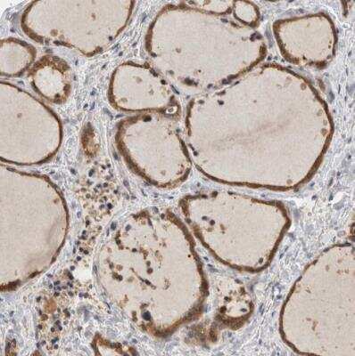 Immunohistochemistry-Paraffin: SAMD12 Antibody [NBP1-81927]