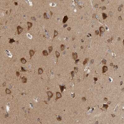 Immunohistochemistry-Paraffin: SAMD12 Antibody [NBP1-81927]