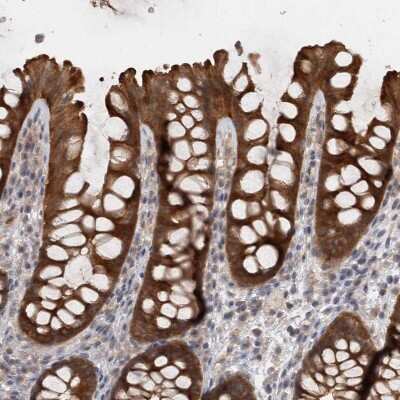 Immunohistochemistry-Paraffin: SAMD12 Antibody [NBP1-81927]
