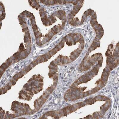 Immunohistochemistry-Paraffin: SAMD12 Antibody [NBP1-81927]