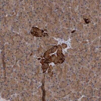 Immunohistochemistry-Paraffin: SAMD12 Antibody [NBP1-81927]