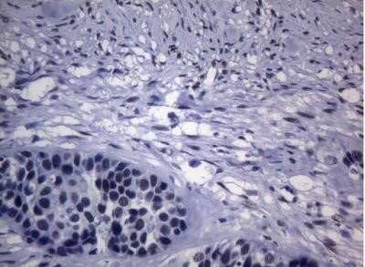 Immunohistochemistry: SAMD12 Antibody (OTI2G1) - Azide and BSA Free [NBP2-73974]