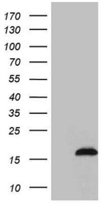 Western Blot: SAMD12 Antibody (OTI2G1)Azide and BSA Free [NBP2-73974]