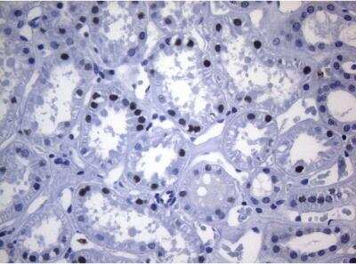Immunohistochemistry-Paraffin: SAMD12 Antibody (OTI2G1) [NBP2-45684]