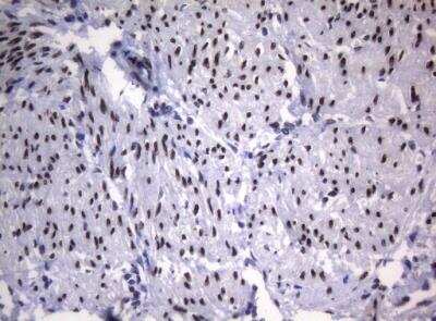 Immunohistochemistry-Paraffin: SAMD12 Antibody (OTI2G1) [NBP2-45684]