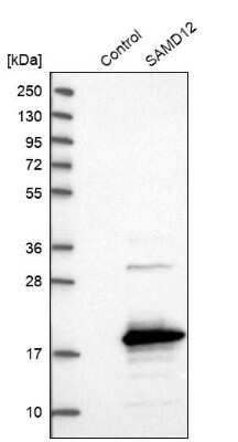 Western Blot: SAMD12 Antibody [NBP1-81927]