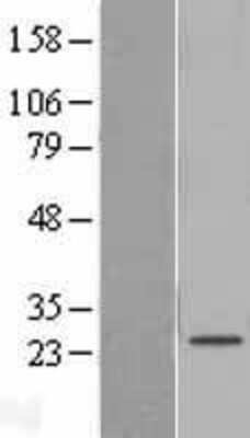 Western Blot: SAMD12 Overexpression Lysate [NBL1-15680]