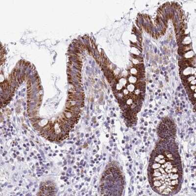 Immunohistochemistry-Paraffin: SAMD13 Antibody [NBP2-31734]