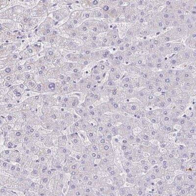 Immunohistochemistry-Paraffin: SAMD13 Antibody [NBP2-31734]
