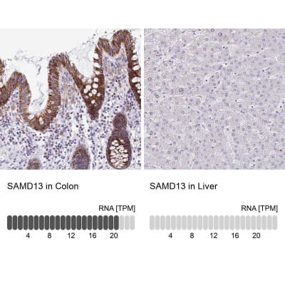 Immunohistochemistry-Paraffin: SAMD13 Antibody [NBP2-31734]