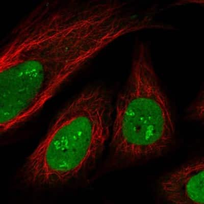 Immunocytochemistry/ Immunofluorescence: SAMD14 Antibody [NBP2-13278]