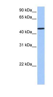 Western Blot: SAMD14 Antibody [NBP1-70699]