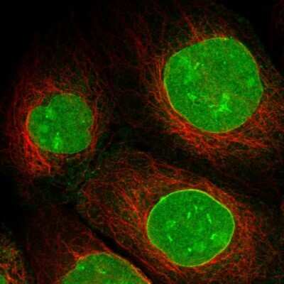 Immunocytochemistry/ Immunofluorescence: SAMD15 Antibody [NBP1-90727]