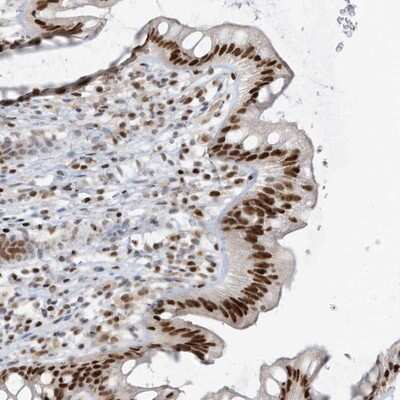 Immunohistochemistry-Paraffin: SAMD15 Antibody [NBP1-90726]