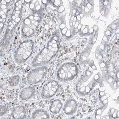 Immunohistochemistry-Paraffin: SAMD15 Antibody [NBP1-90727]