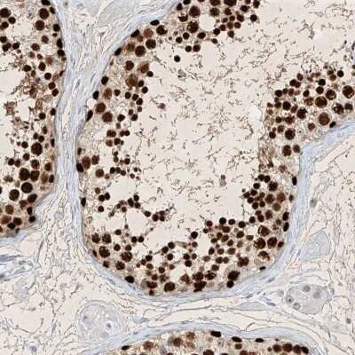 Immunohistochemistry-Paraffin: SAMD15 Antibody [NBP1-90727]