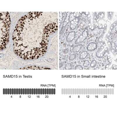 Immunohistochemistry-Paraffin: SAMD15 Antibody [NBP1-90727]