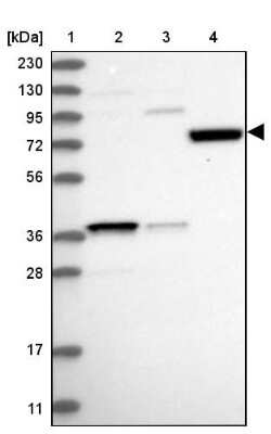 Western Blot: SAMD15 Antibody [NBP1-90726]