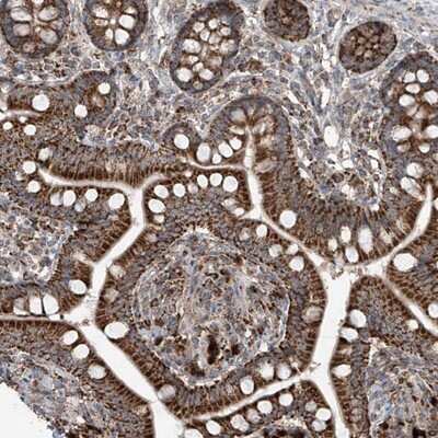 Immunohistochemistry-Paraffin: SAMD3 Antibody [NBP1-88731]