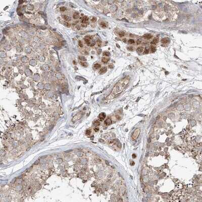 Immunohistochemistry-Paraffin: SAMD3 Antibody [NBP1-88731]