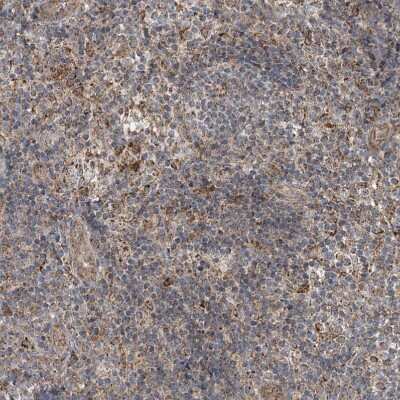 Immunohistochemistry-Paraffin: SAMD3 Antibody [NBP1-88731]