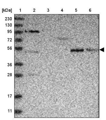 Western Blot: SAMD3 Antibody [NBP1-88731]