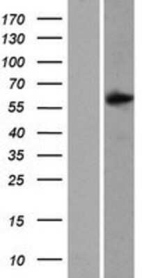 Western Blot: SAMD3 Overexpression Lysate [NBP2-08682]