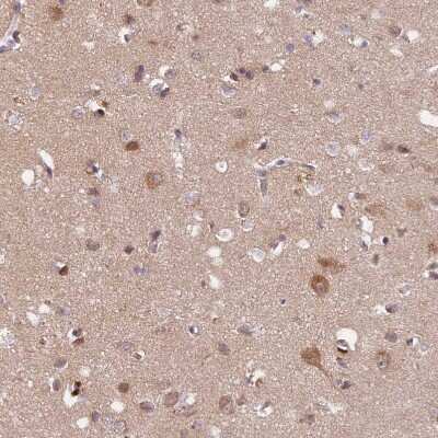 Immunohistochemistry-Paraffin: SAMD4A Antibody [NBP2-13279]