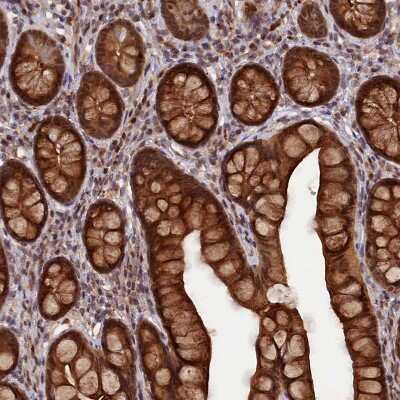 Immunohistochemistry-Paraffin: SAMD4A Antibody [NBP2-13279]