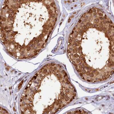 Immunohistochemistry-Paraffin: SAMD4A Antibody [NBP2-13279]