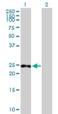 Western Blot: SAMD4A Antibody [H00023034-B01P]