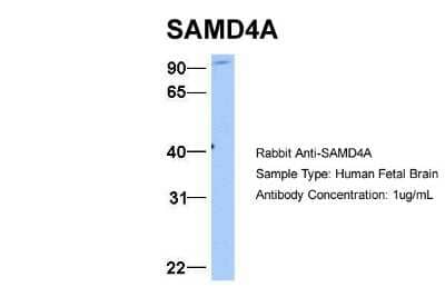 Western Blot: SAMD4A Antibody [NBP1-57597]