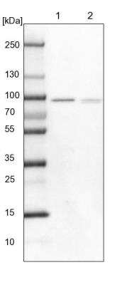 Western Blot: SAMD4A Antibody [NBP2-13279]