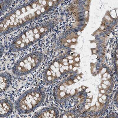 Immunohistochemistry-Paraffin: SAMD4B Antibody [NBP1-94045]